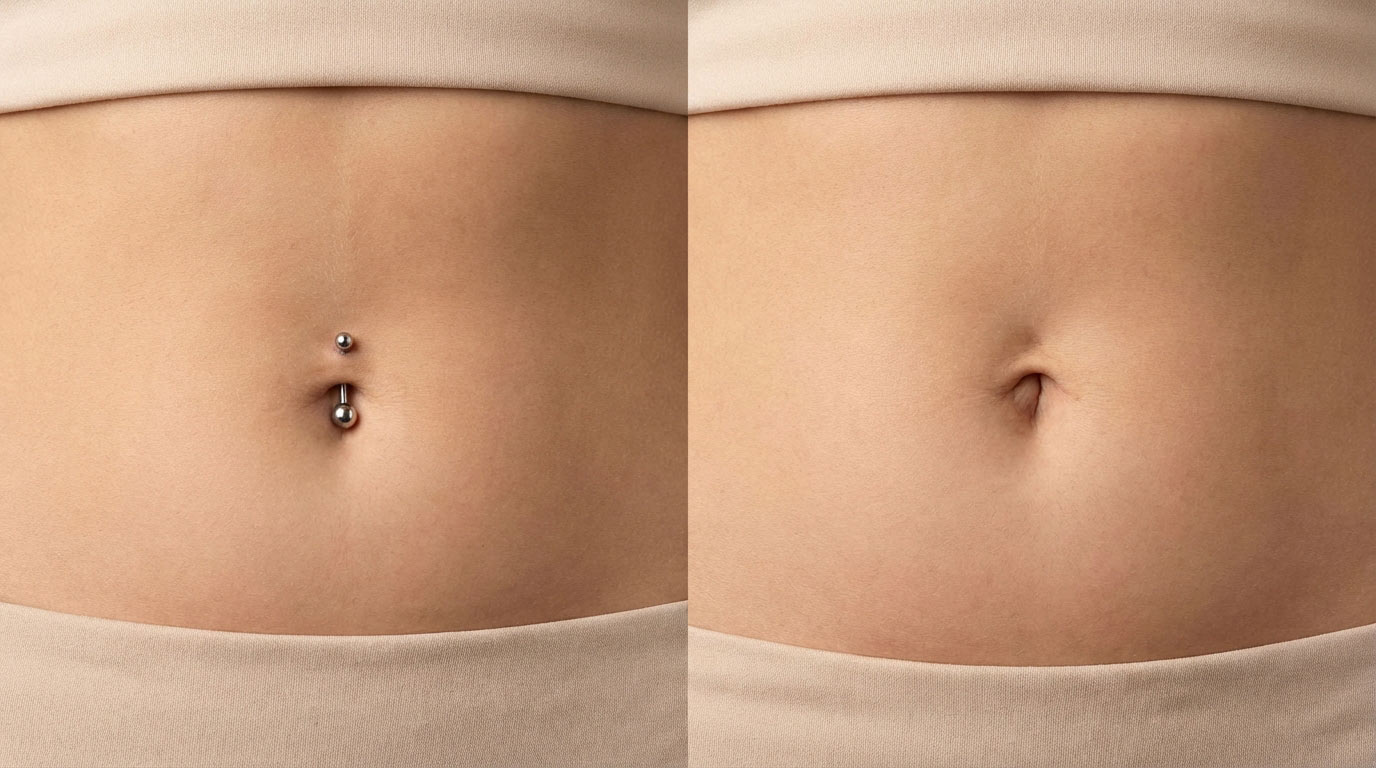 Navel anatomy comparison innie vs outie belly button — showing standard innie with titanium curved barbell and outie navel without jewelry for piercing candidacy assessment